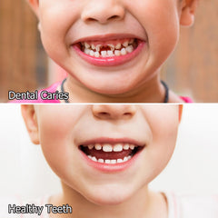 MesoFill enamel protection graphic