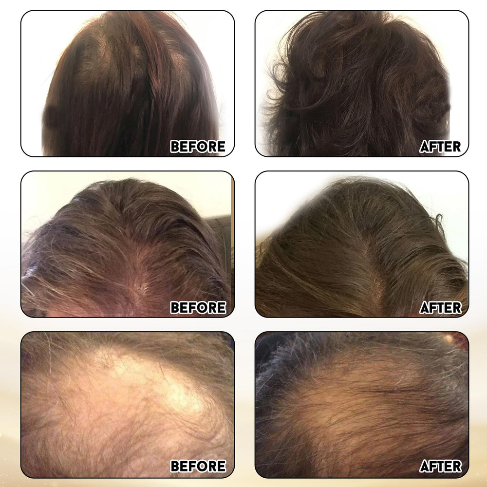 Biotin-rich Miracle Elixir supplement bottle close-up