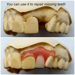 Gum Material repairing missing teeth