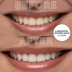 Box of 56 peppermint-flavored whitening strips