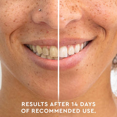 MOON Dissolving Whitening Strips package – 56 count