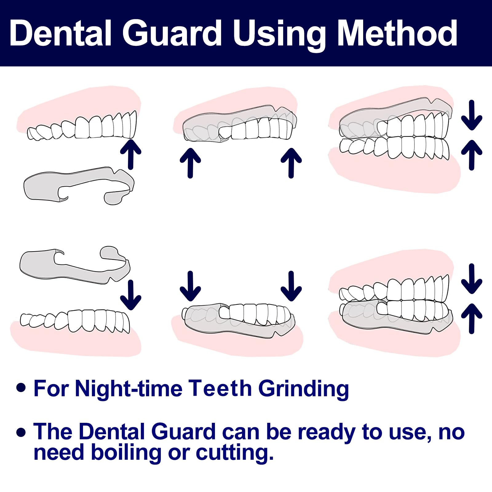 Close-up of BPA-free dental guard