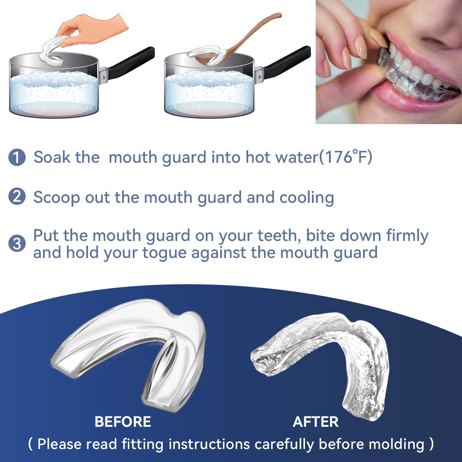 Storage case for mouth guards