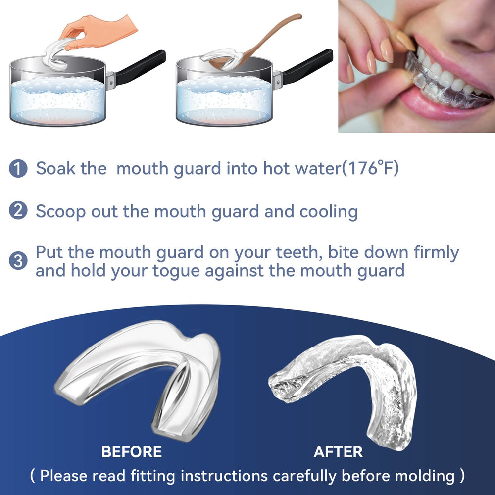Storage case for mouth guards