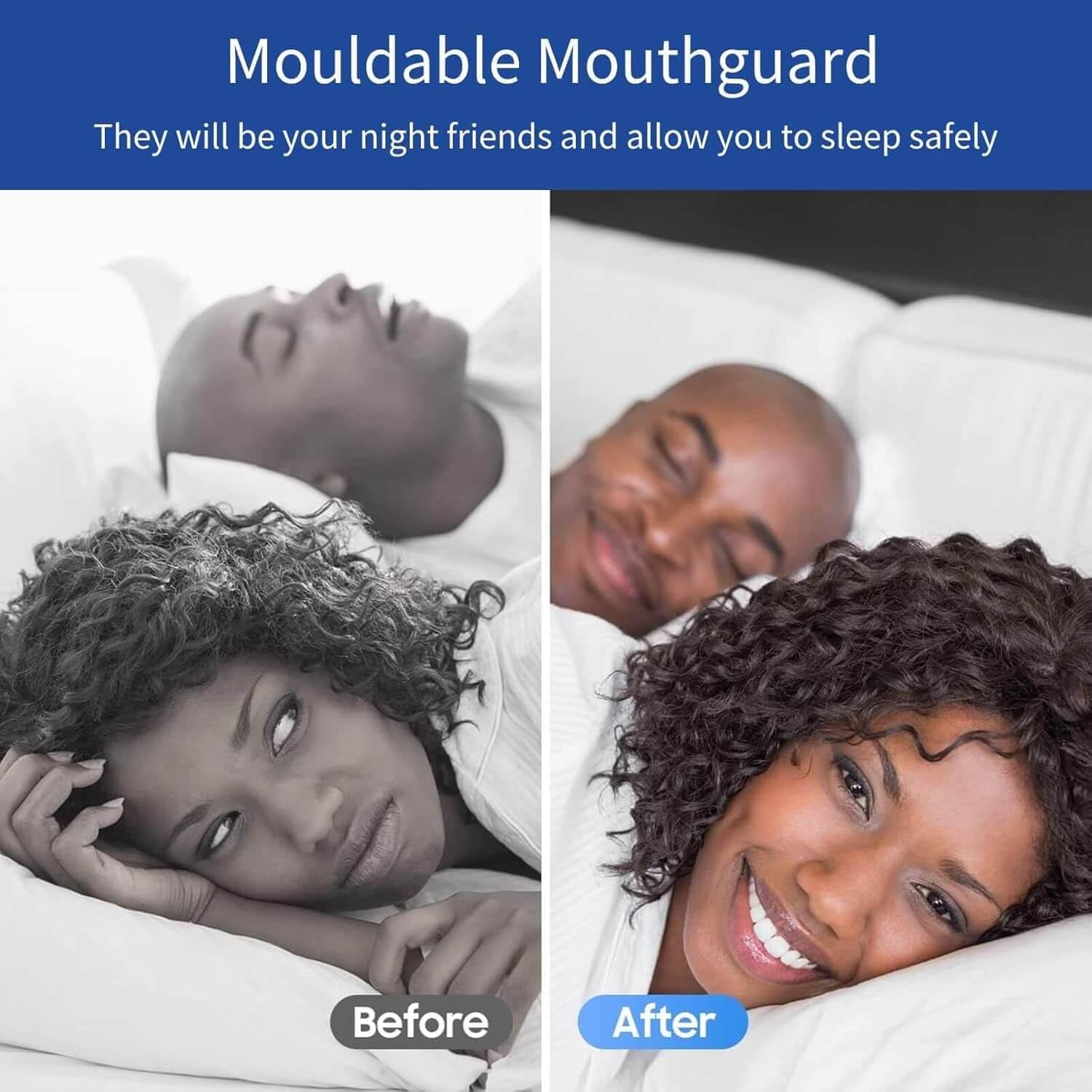 Mouthguards for grinding of teeth product photo