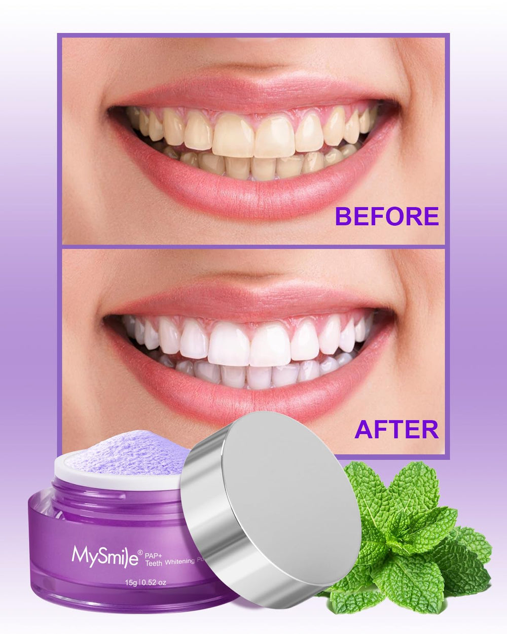 MySmile DY156 packaging with whitening powder accessory