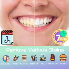 Open kit showing 14 pairs (28 sheets) of PAP whitening strips