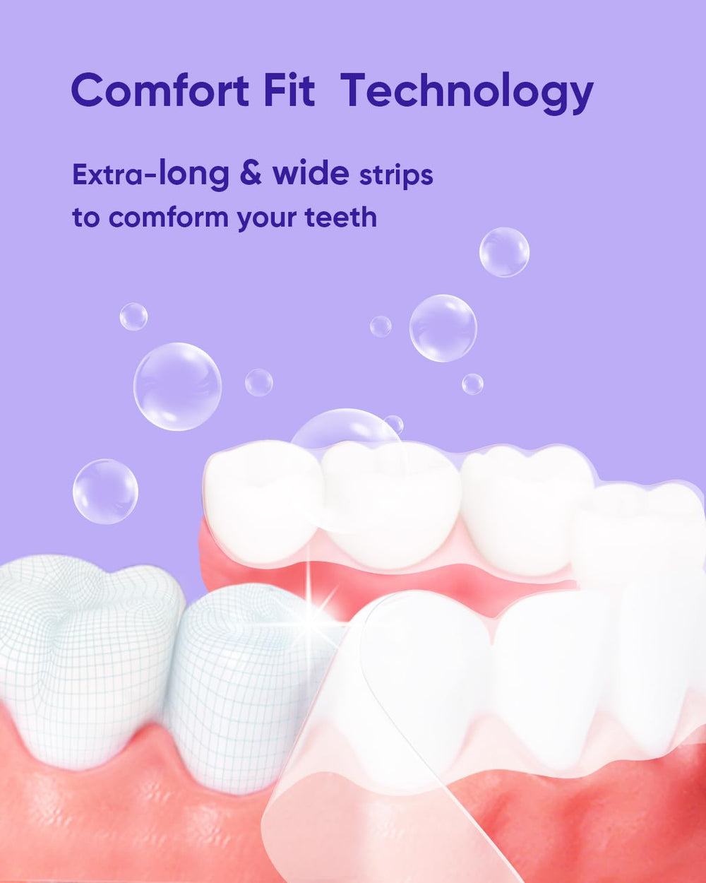 MySmile whitening gel pen