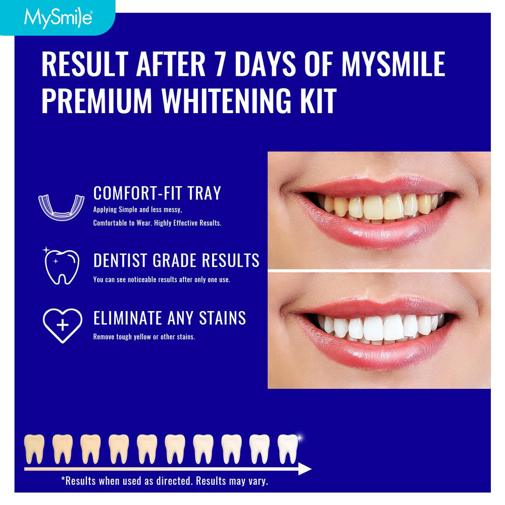Kit includes 14 prefilled trays for a 7-day whitening routine
