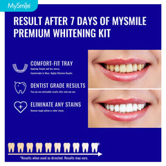 Kit includes 14 prefilled trays for a 7-day whitening routine