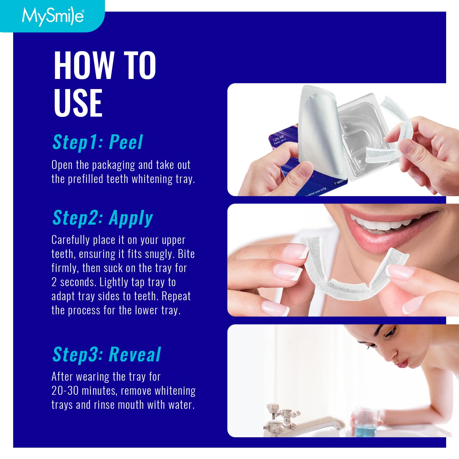 No LED light required for at-home whitening