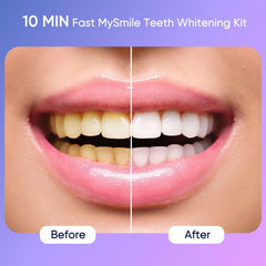 LED light unit and whitening gel close-up