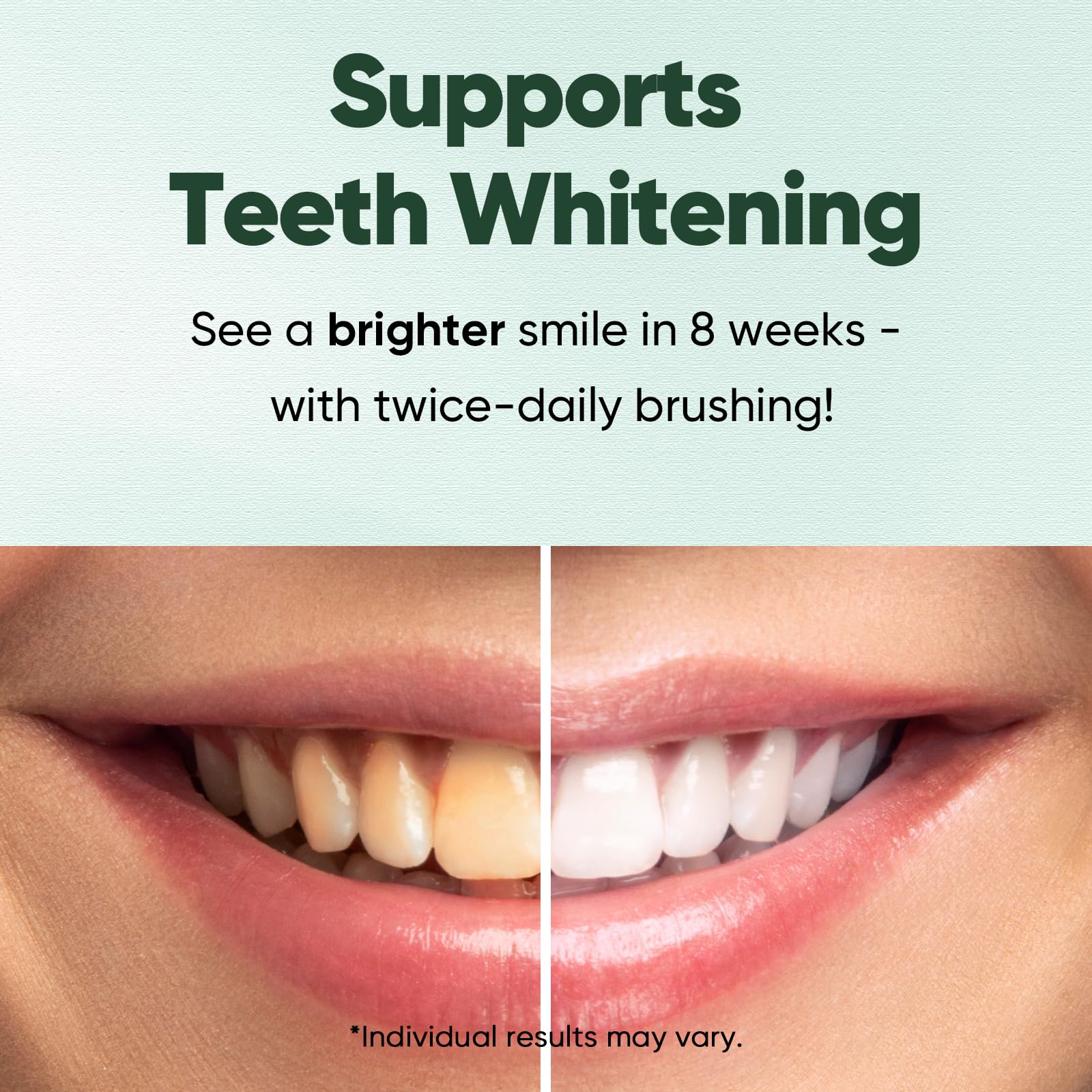 Kit includes whitening strips and fluoride-free toothpaste 4.2oz