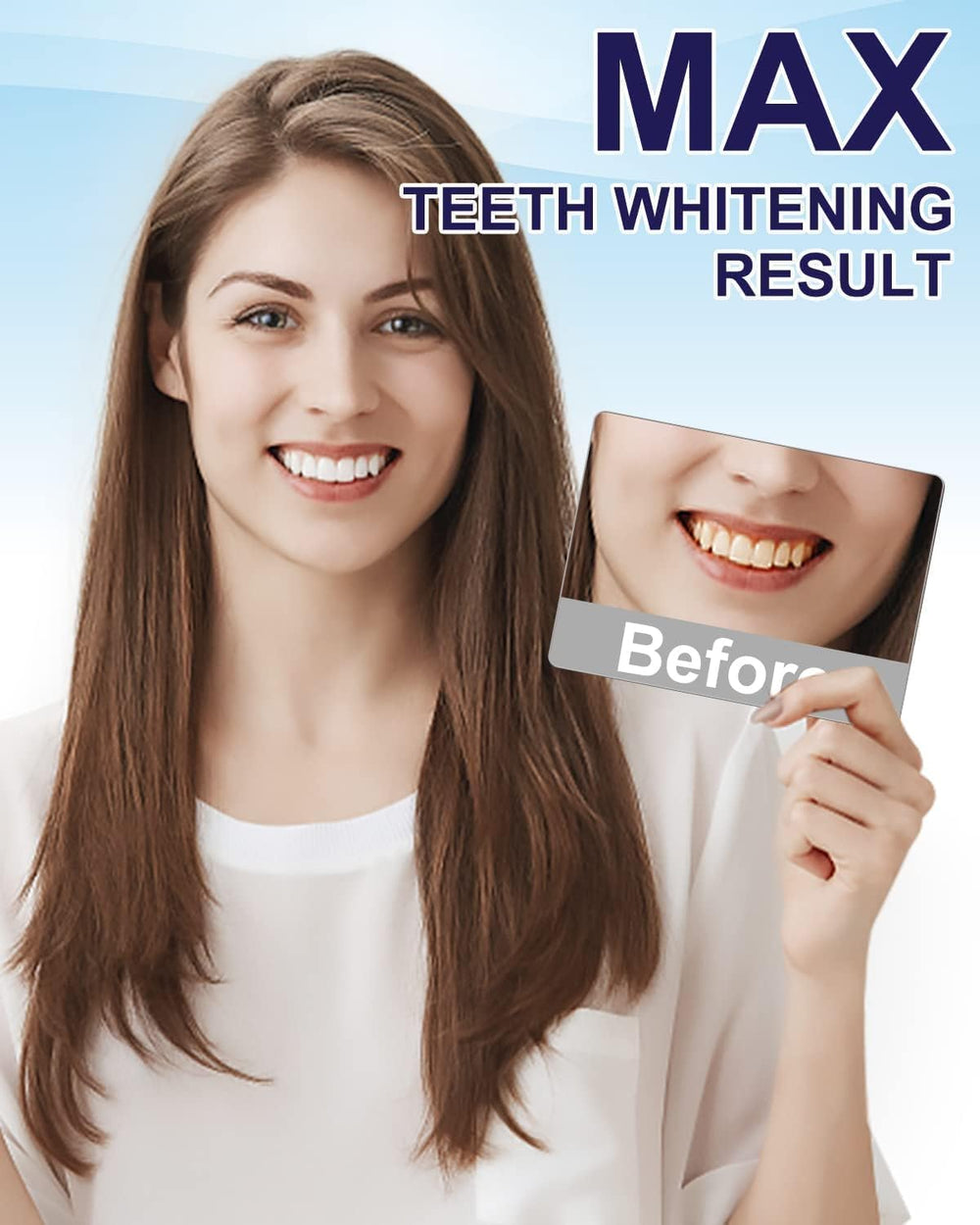 Compact travel-friendly MySmile whitening pen