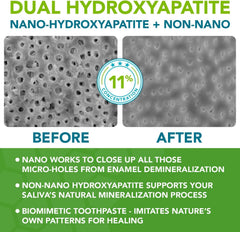 Dentist-formulated remineralizing toothpaste packaging image