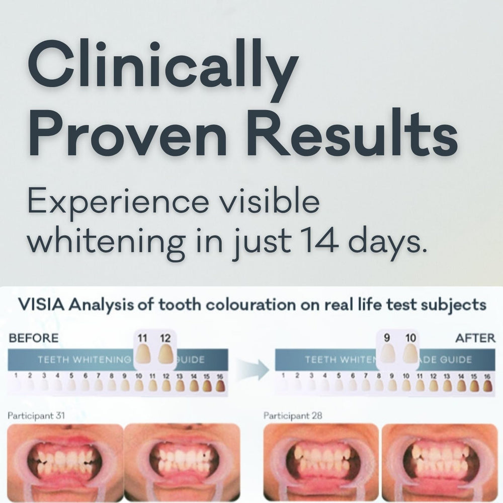 Nano-Hydroxyapatite toothpaste for enamel remineralization