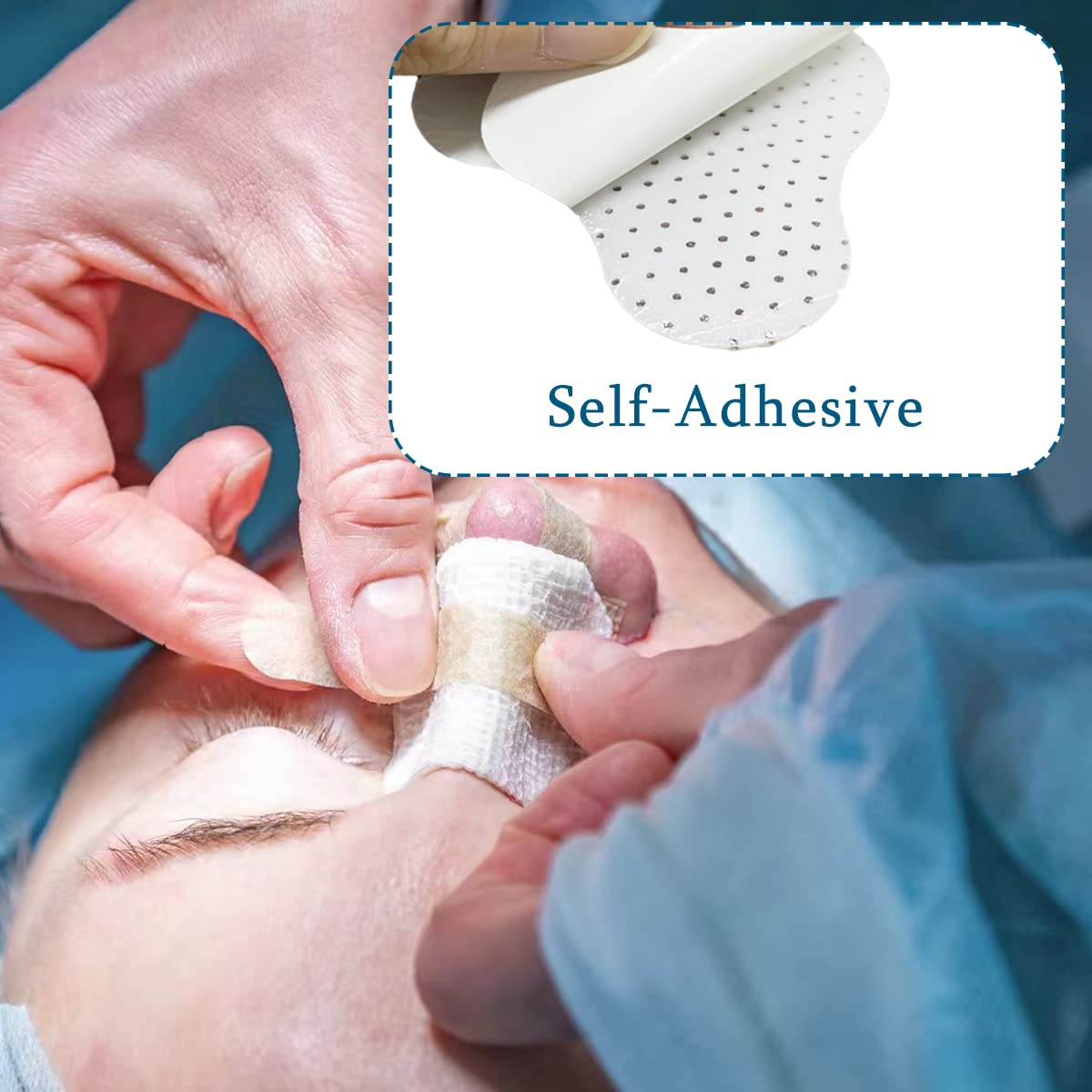Nasal splints placed on nose after activation