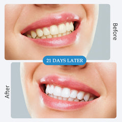 All-natural ingredients used in whitening strips