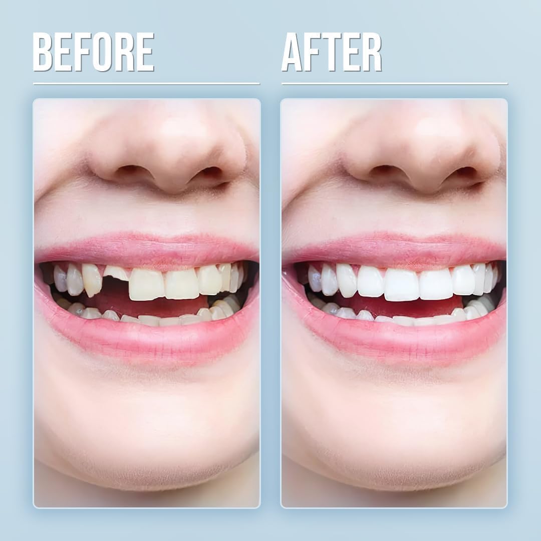 Model wearing natural-looking dentures