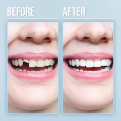 Model wearing natural-looking dentures