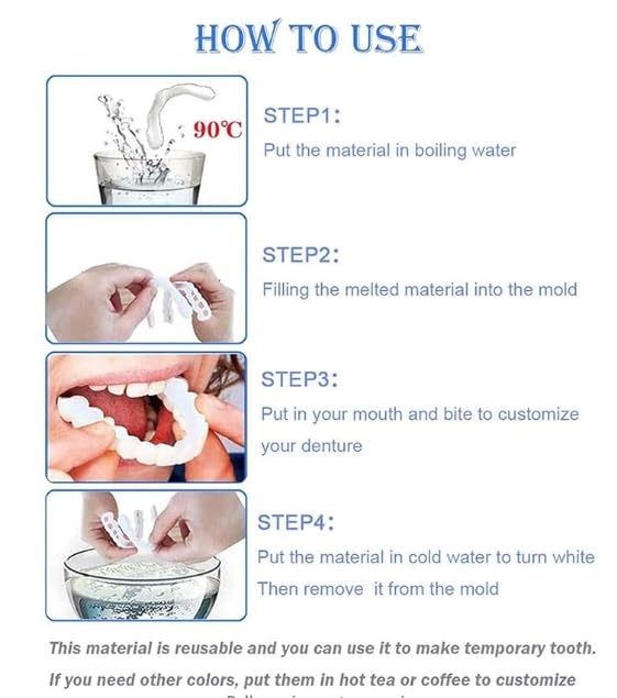 Top and bottom aligners offering a natural smile