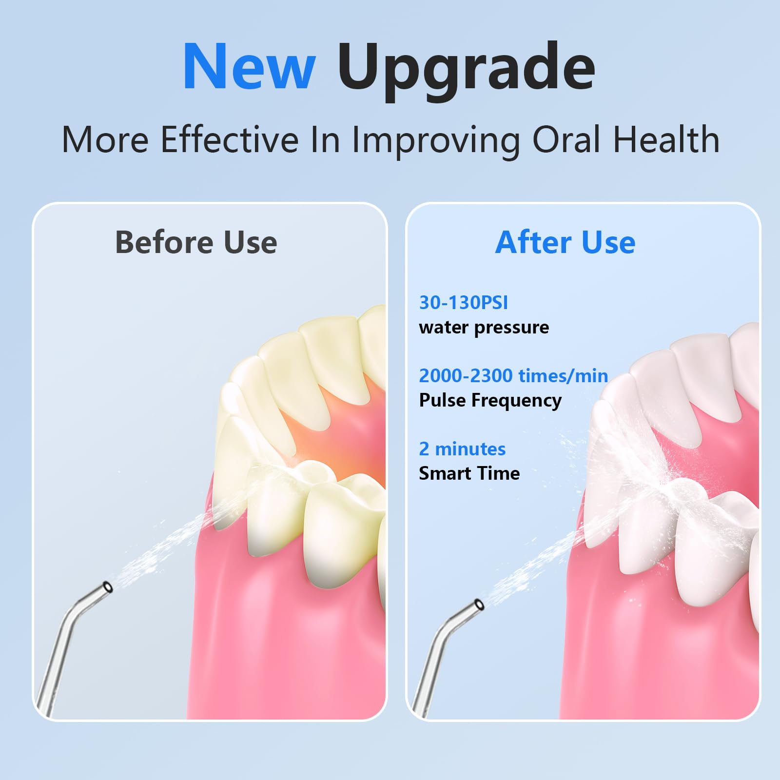 Six jet tips for NBGRLVS flosser including orthodontic and tongue cleaners