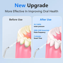 Six jet tips for NBGRLVS flosser including orthodontic and tongue cleaners