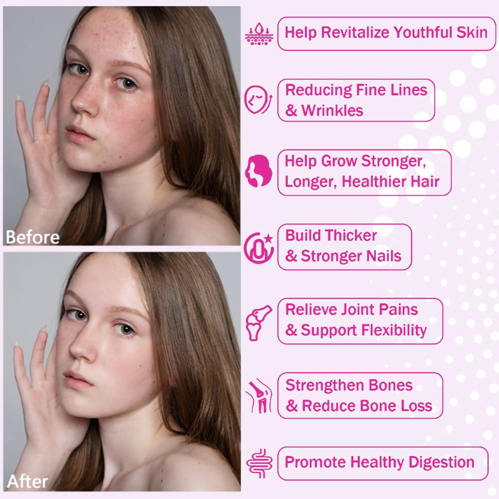 Hyaluronic acid, biotin and vitamin C ingredients