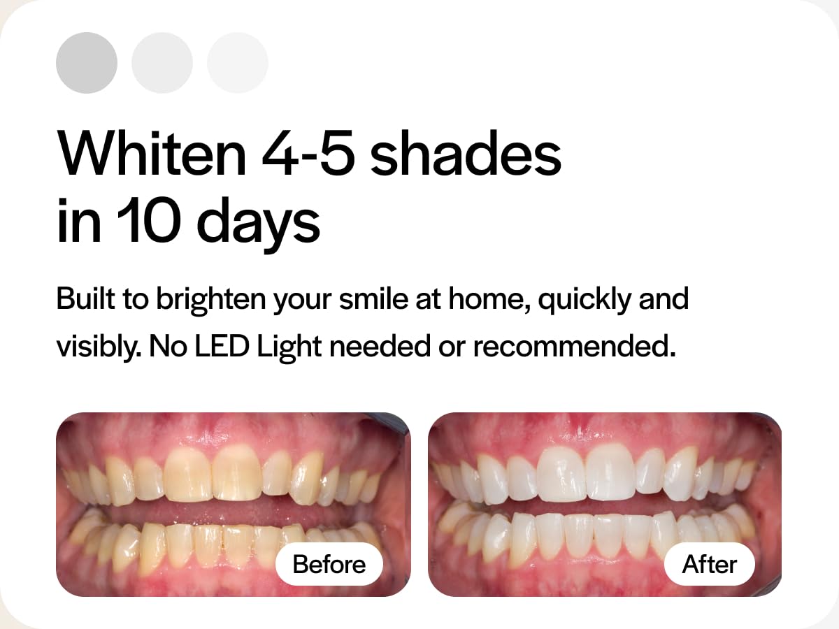 Whitening trays compatible with Invisalign and other trays