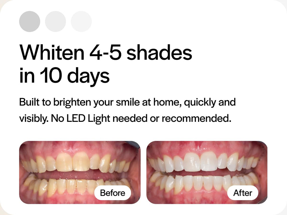 Whitening trays compatible with Invisalign and other trays