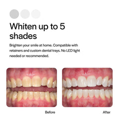 Twelve 1.2 ml Opalescence whitening syringes laid out
