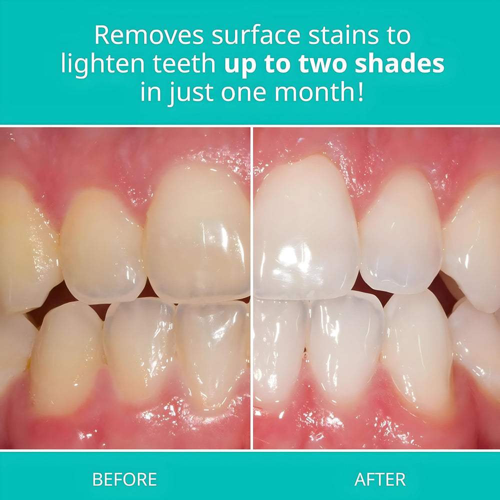 Gluten-free label on Opalescence Original Formula toothpaste