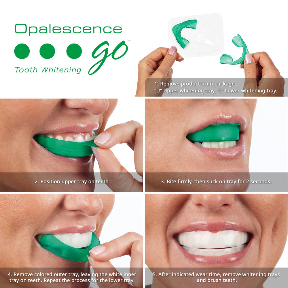 Close-up of Opalescence Go Mint 10% trays.