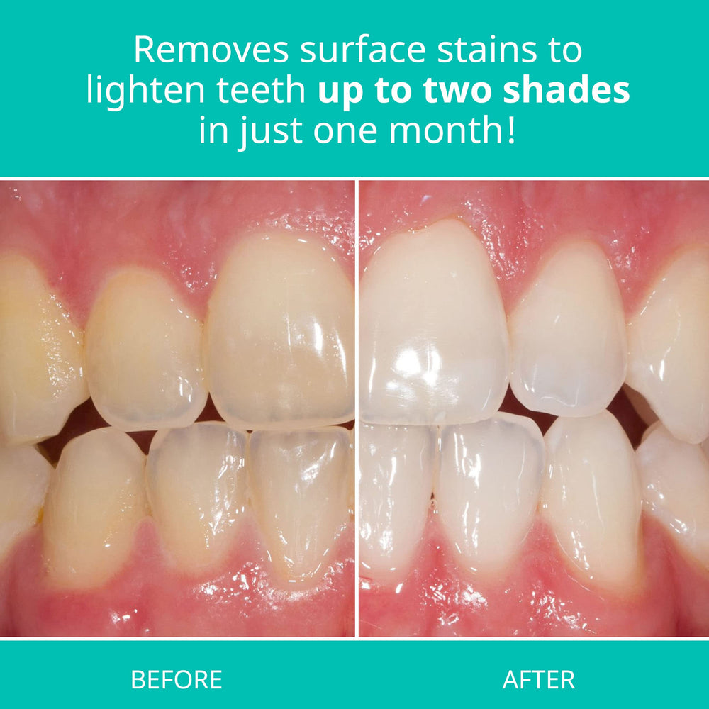 Kosher and gluten-free icons on Opalescence toothpaste packaging