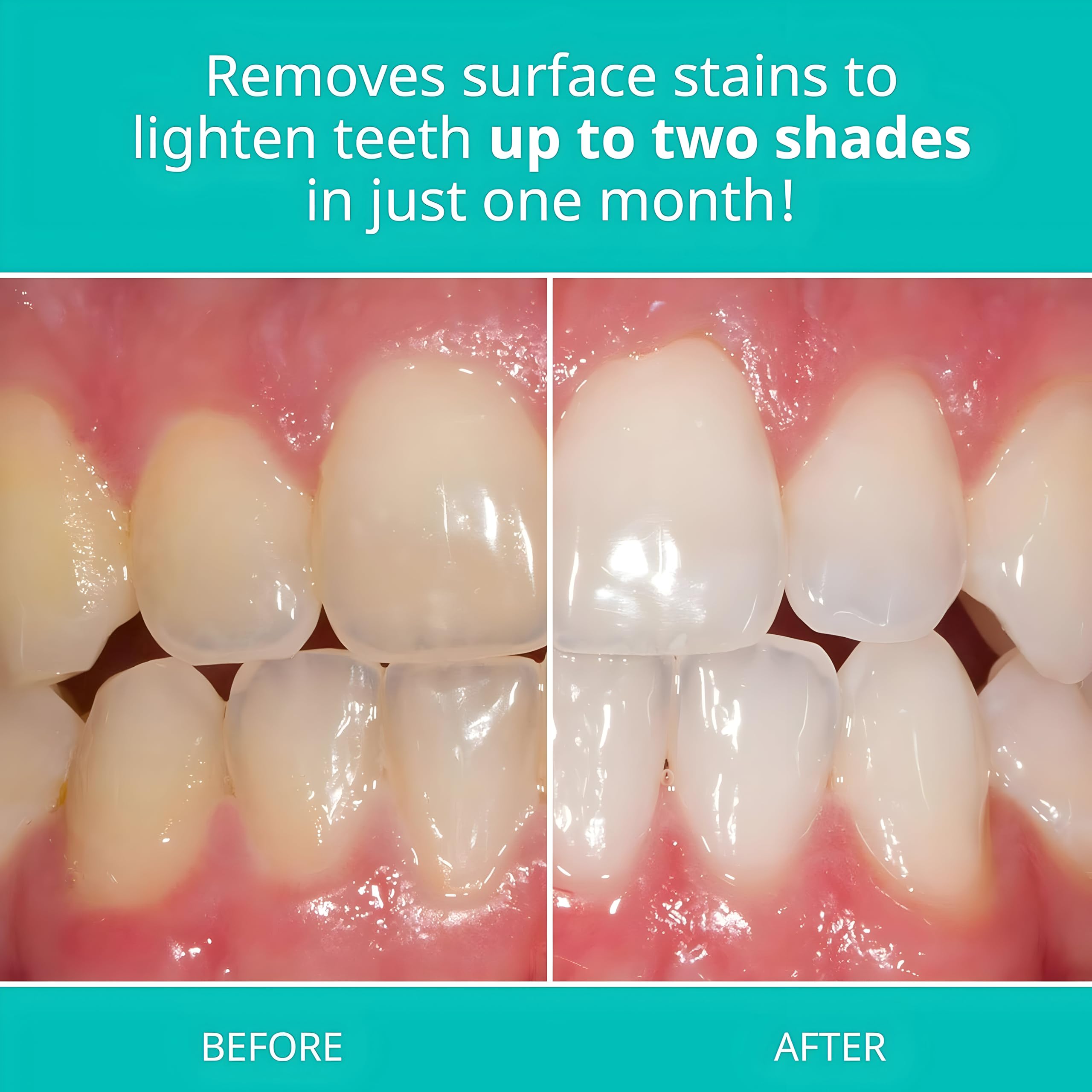 Opalescence toothpaste packaging with TP-5167-1