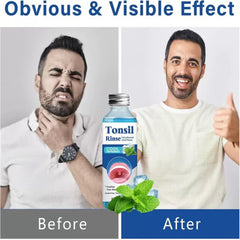 Illustration of natural herbal ingredients used in the mouthwash