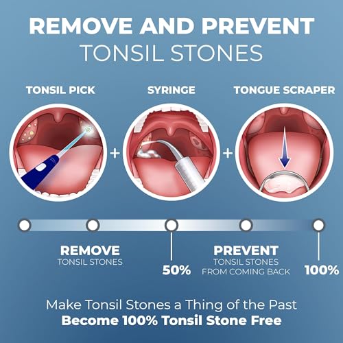 Tonsil stone remover tool in hand from ORAVIX kit