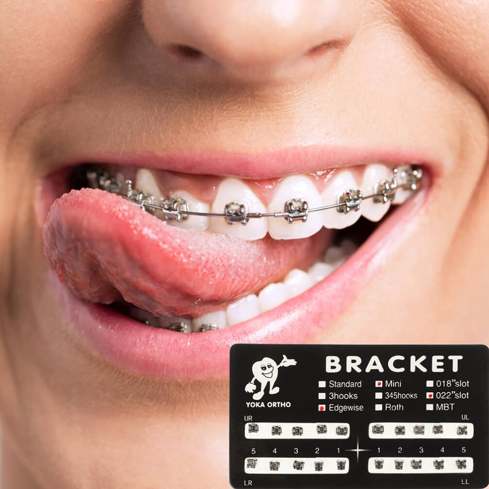 Detailed view of bracket edges and hooks