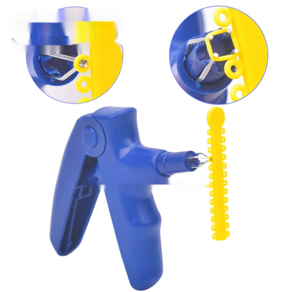 Assorted color ligature ties displayed for braces