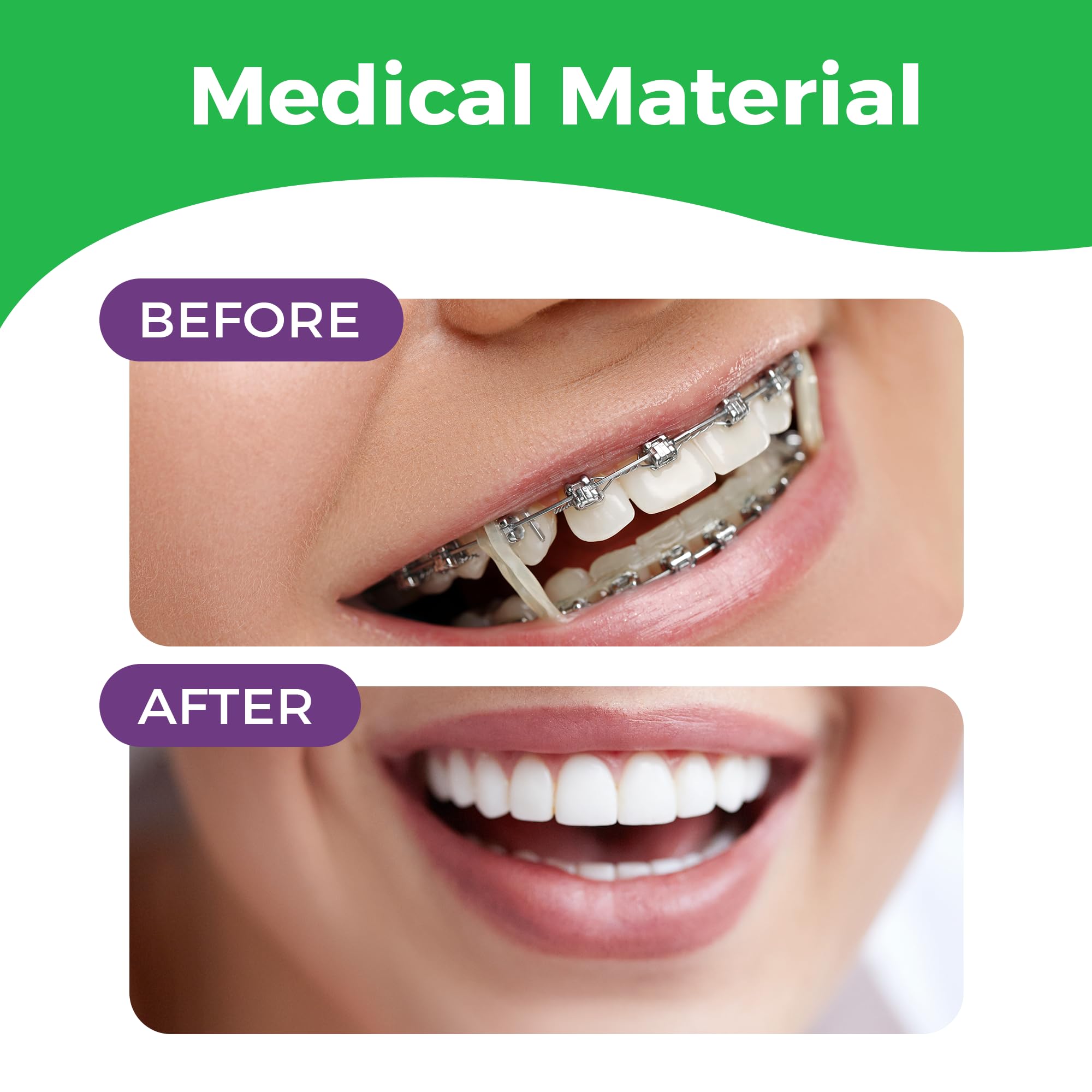 Durable 1/4 inch orthodontic elastics for braces and hair styling
