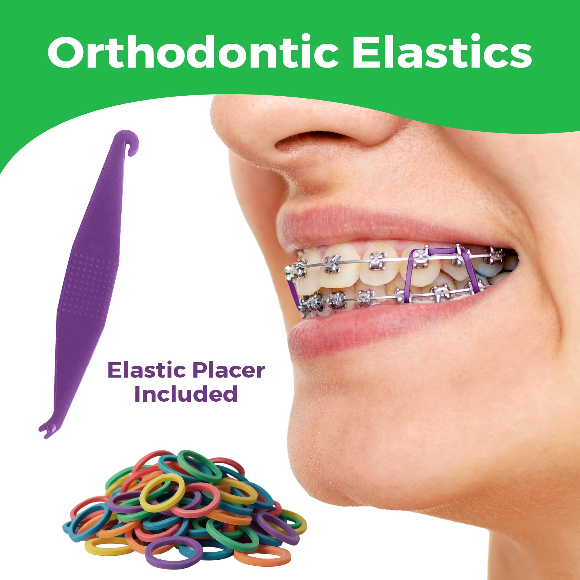 Braces elastics in neon color for teeth alignment and hair styling