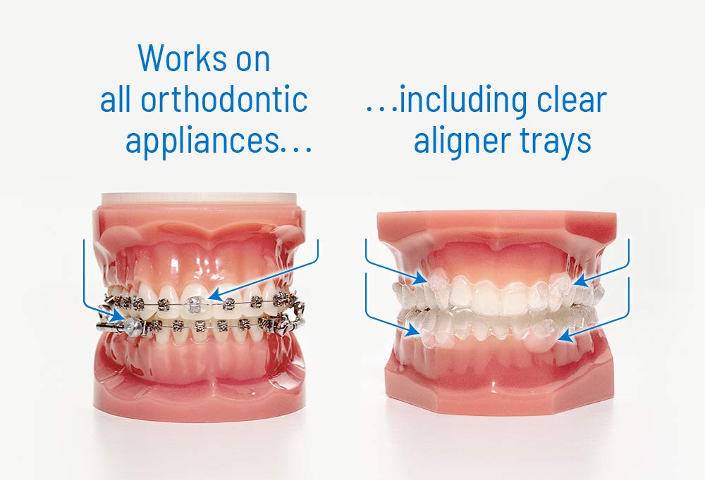 Moisture-activated OrthoDots adhering to braces