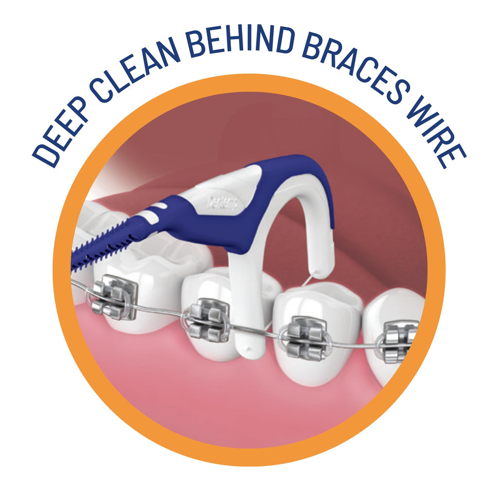 Diagram showing how to use OrVance Braces Flosser for braces cleaning