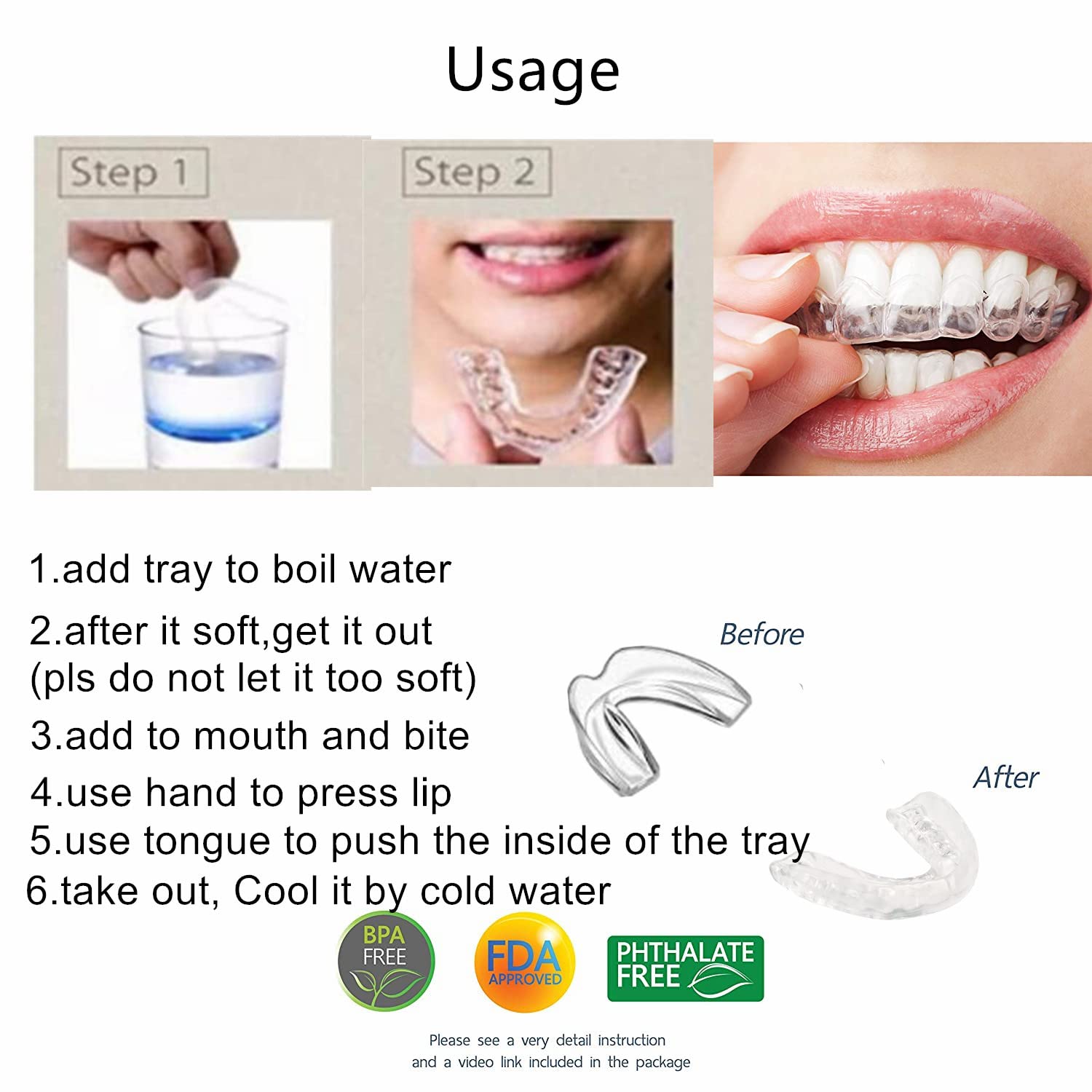 Lifestyle shot of four guards with whitening tray and box