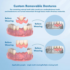 Custom-molded denture base ensuring comfortable daily wear.