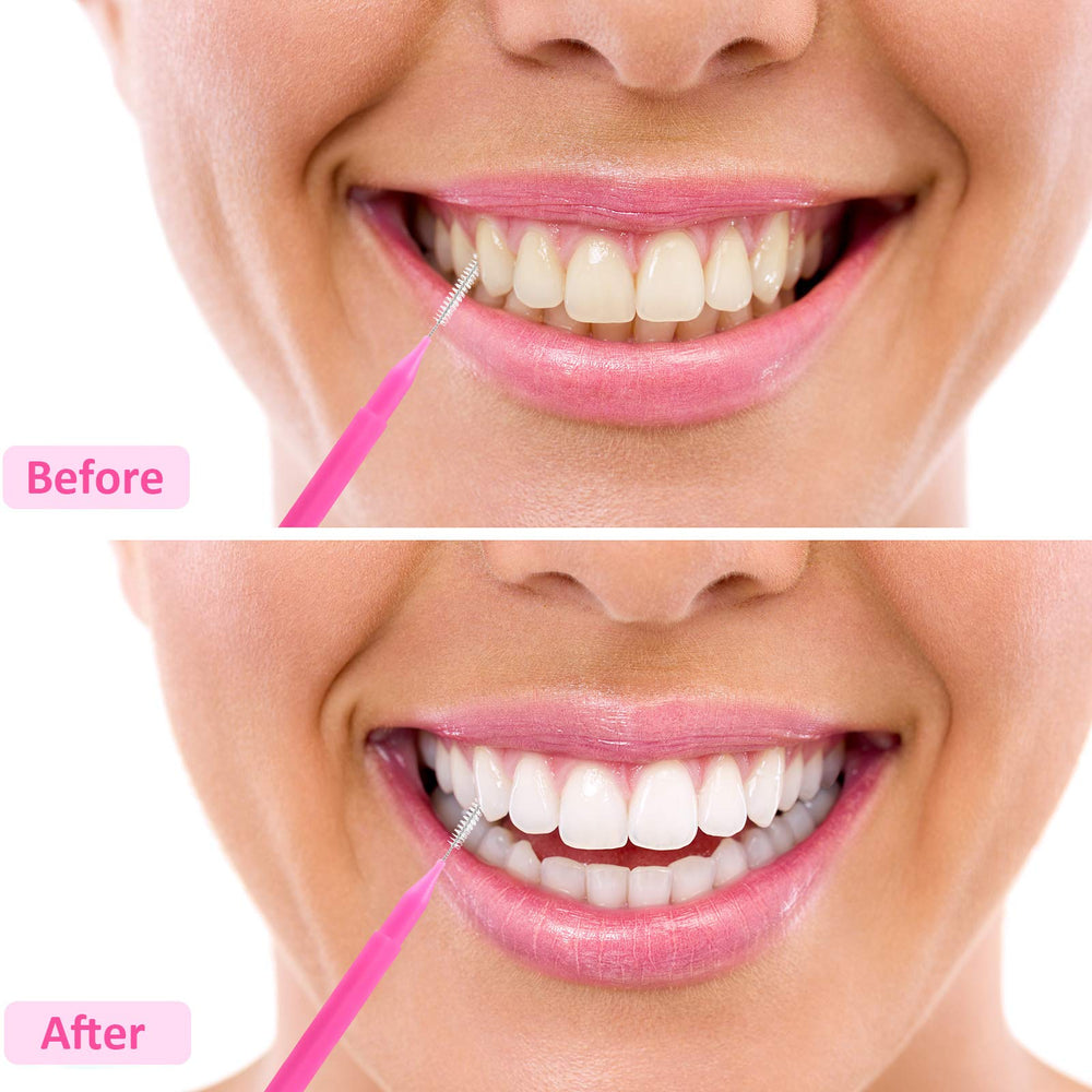 Packaging and variety: multiple sizes and colors in the Patelai set