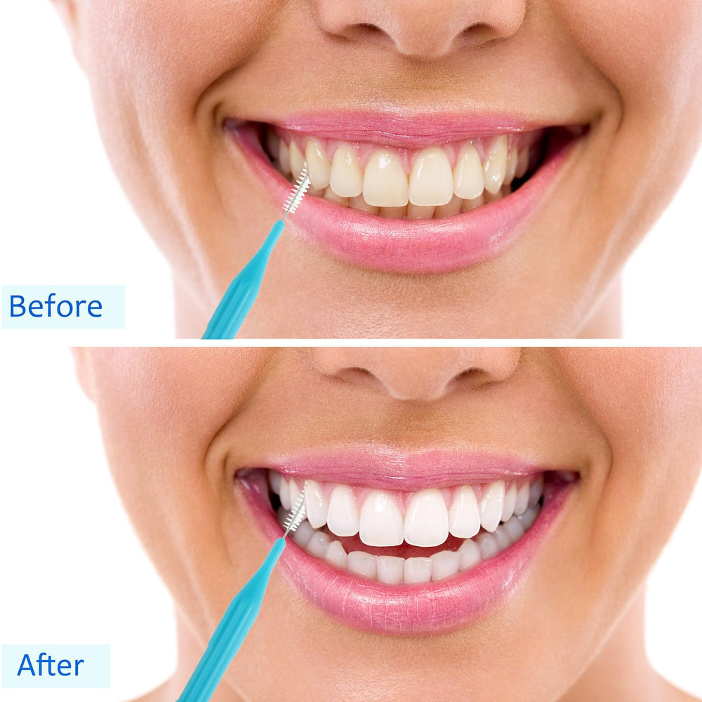 Pack contents: 100 interdental brushes with color variations (blue and pink)