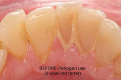 Periogen 3-PK ingredients label