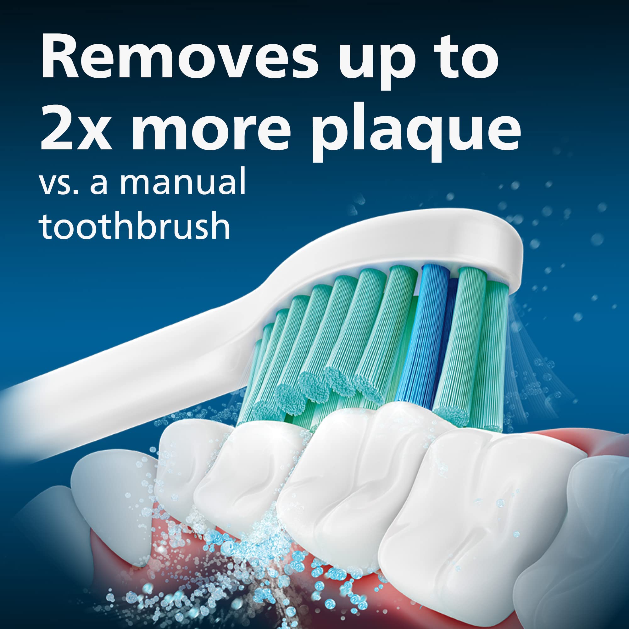 Contoured bristles on Philips Sonicare E-Series replacement heads