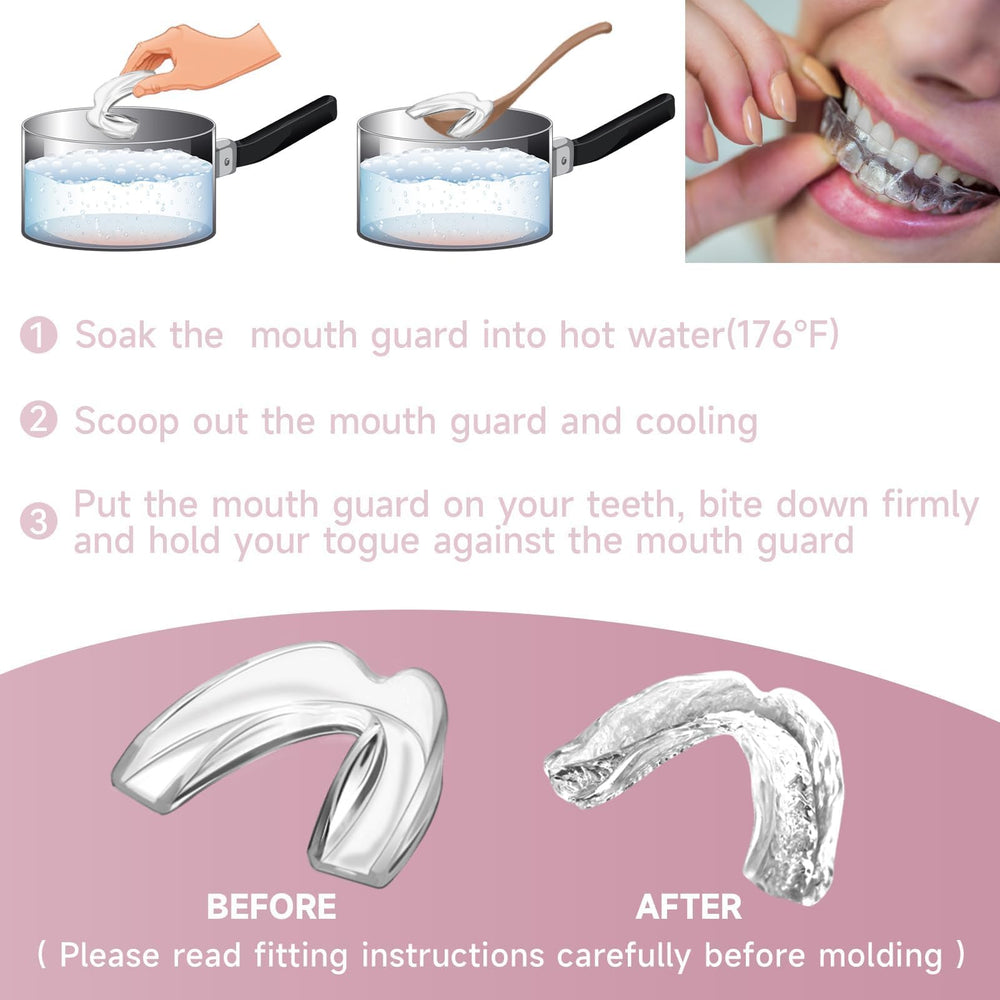 Night guard designed for teens and women in pink